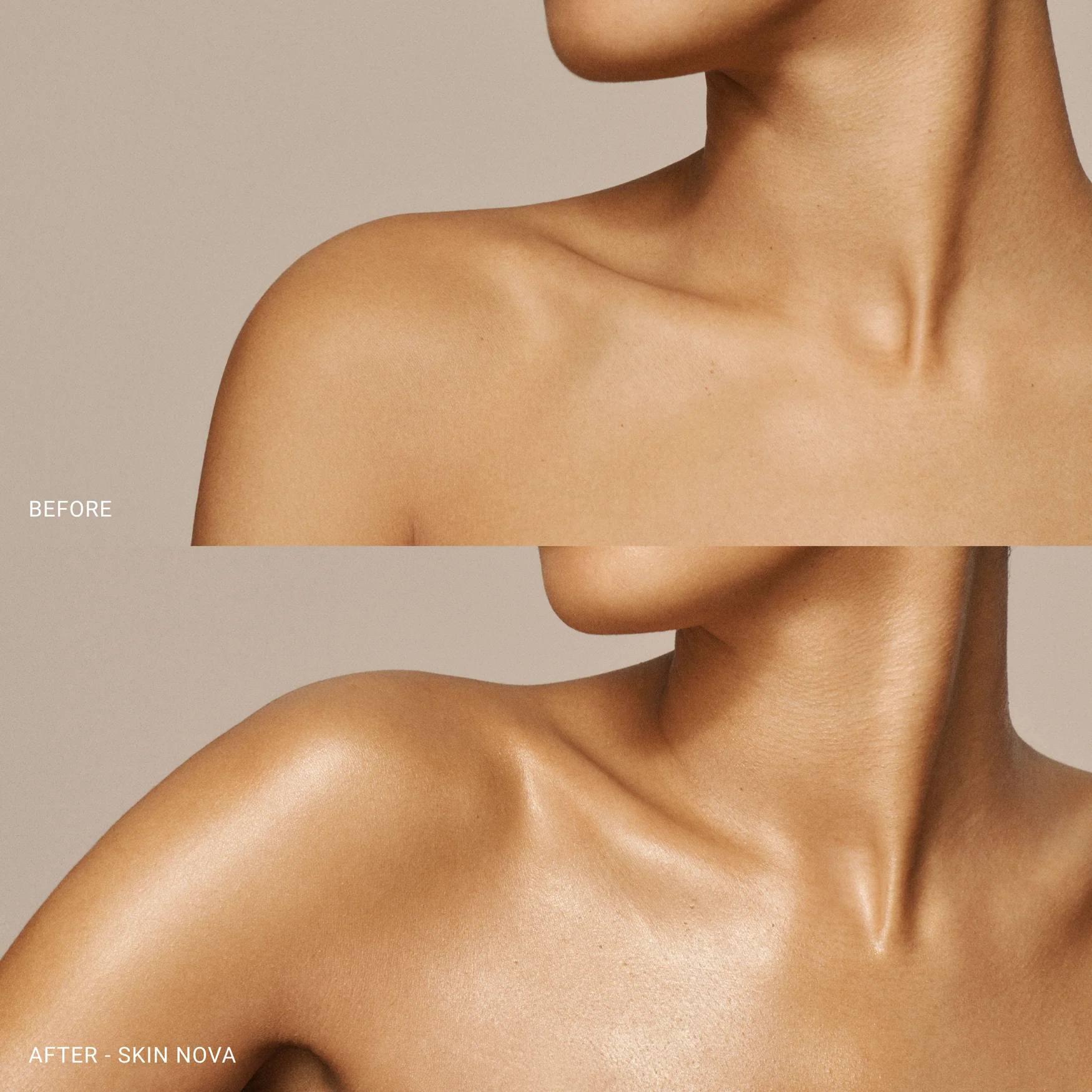 Skin Nova - Image 6