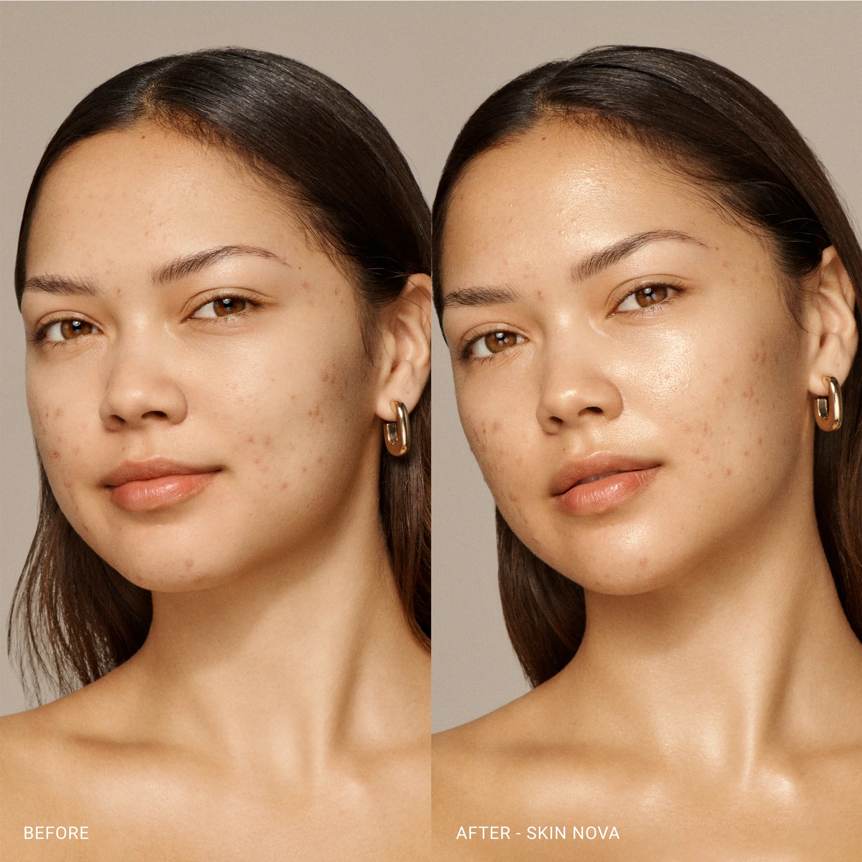 Skin Nova Travel Size - Image 4