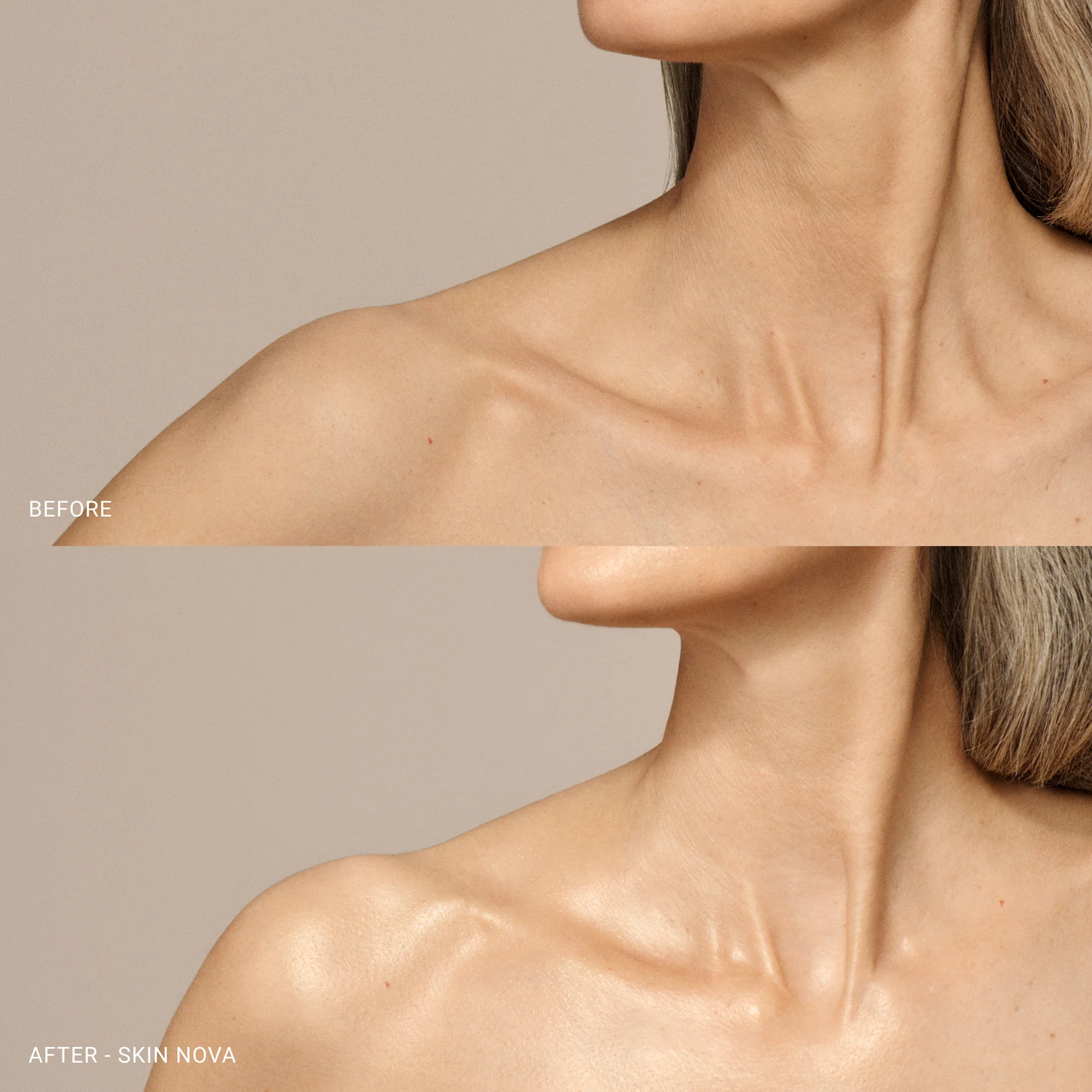 Skin Nova XL - Image 7